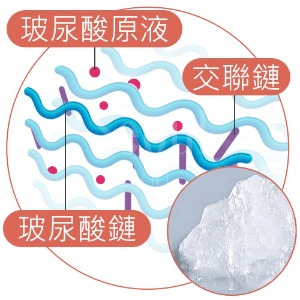 顆粒型玻尿酸結構示意圖，由固態與液態交聯及未交聯玻尿酸混合而成