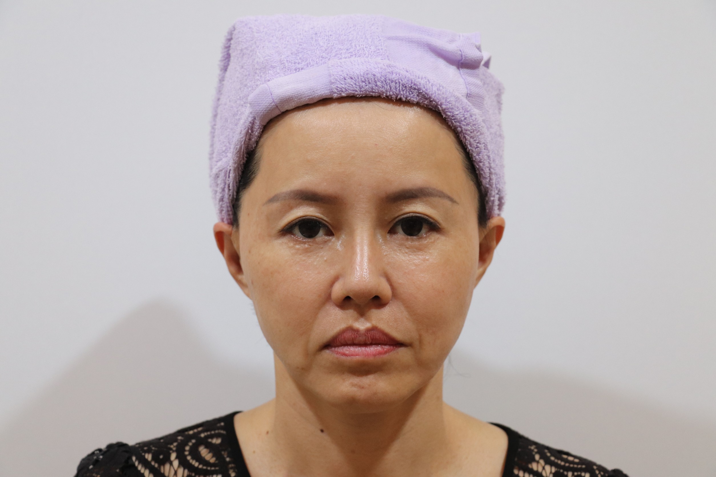 Before image