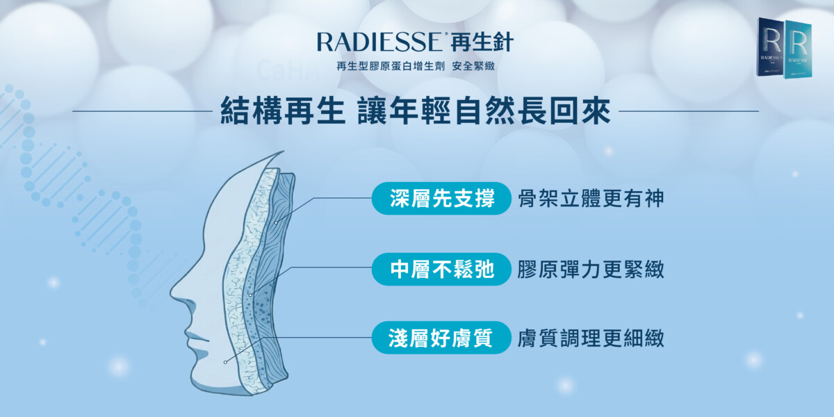 Radiesse 再生針 結構再生：深層支撐、中層緊緻、淺層膠原新生