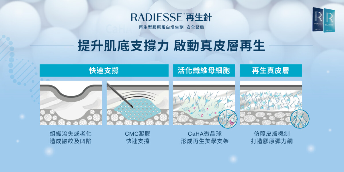 再生針提升肌底支撐